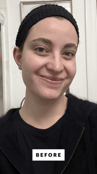 Felbin before applying the Knours PDRN Rice  Green Tea Revitalizing Serum